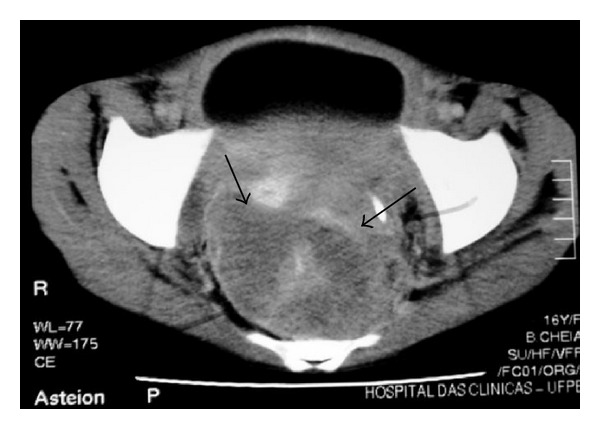 Figure 23