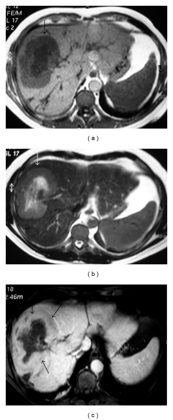 Figure 19