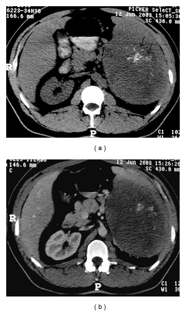 Figure 13