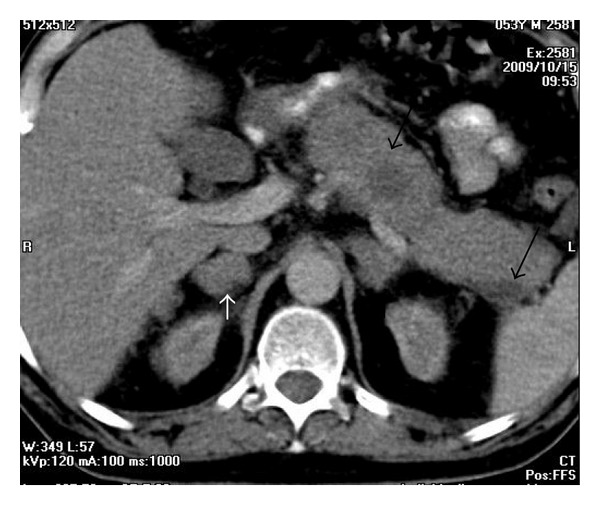 Figure 26