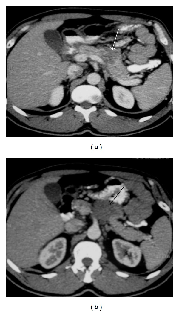 Figure 25