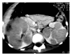 Figure 27