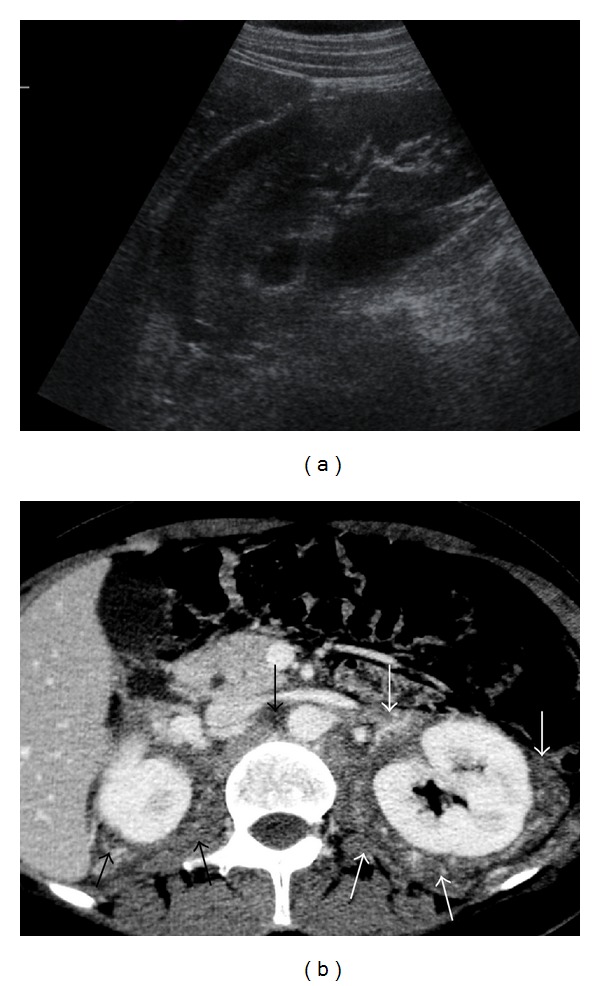 Figure 29