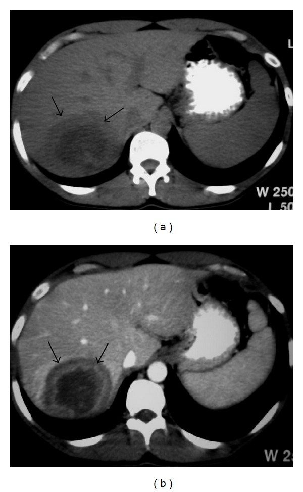 Figure 18