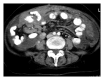 Figure 32