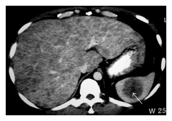 Figure 16