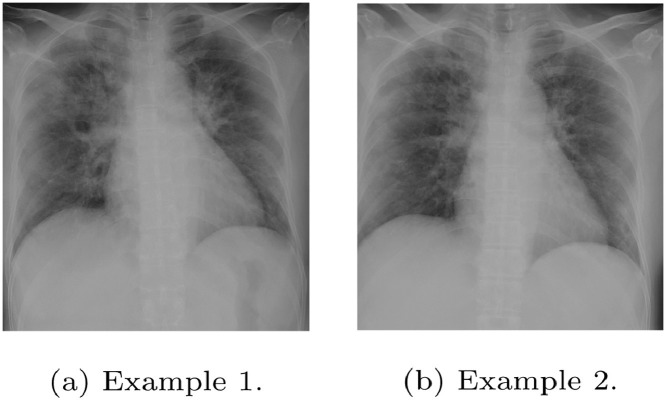 Fig. 13