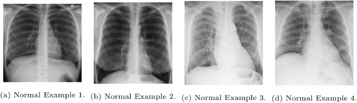 Fig. 14