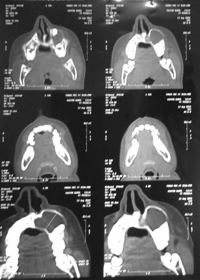 Figure 3