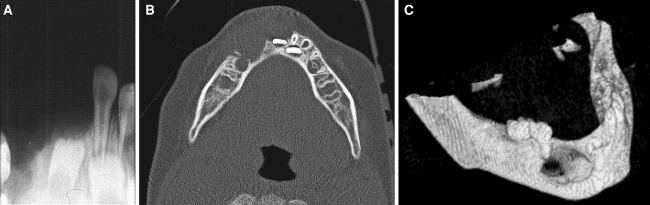 Fig. 1