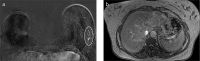 Figure 2. a, b