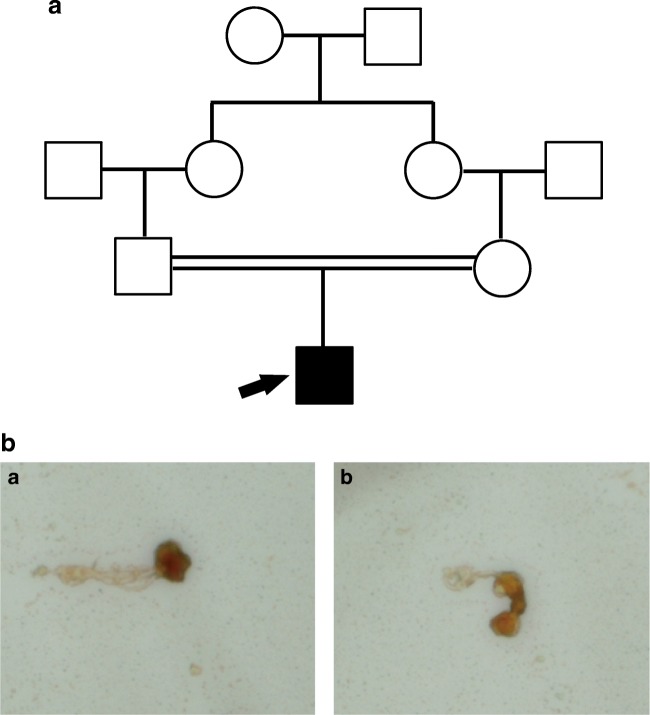 Fig. 1