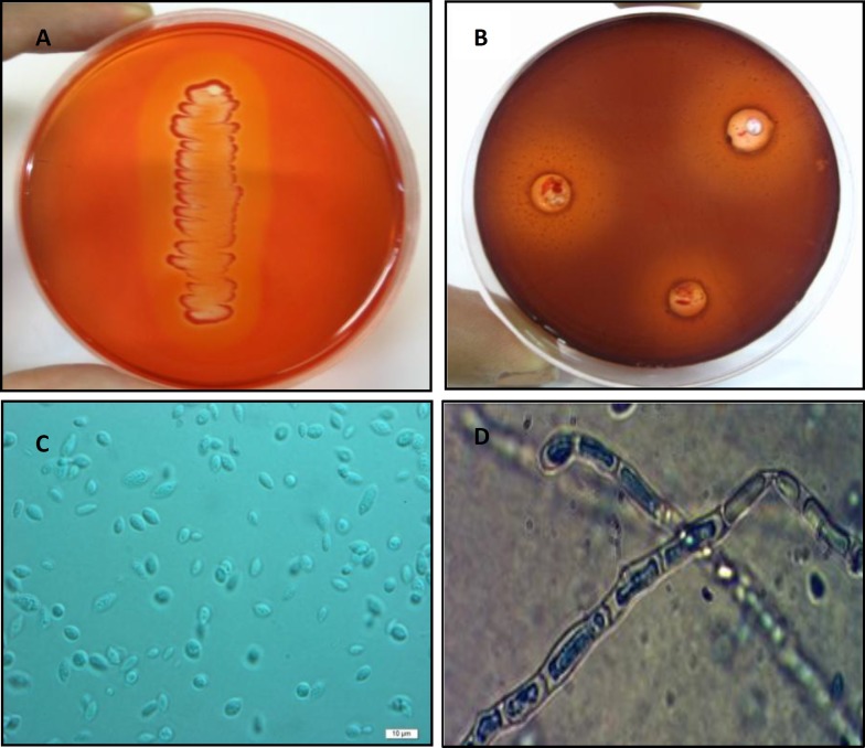 Figure 1. A)