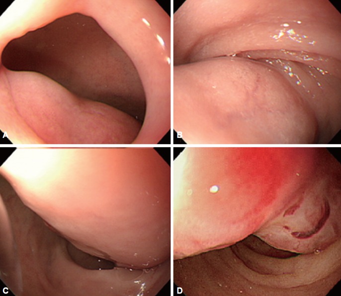 Fig. 2.