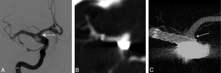 Fig 2.