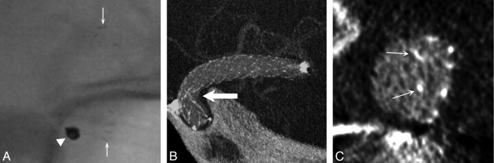 Fig 5.