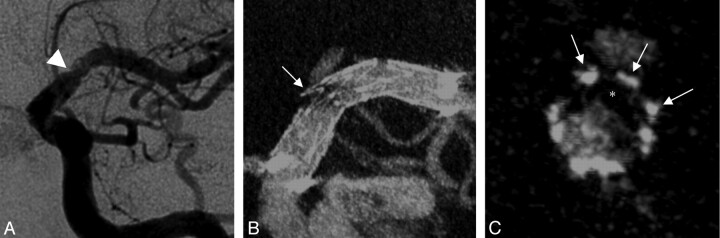 Fig 3.