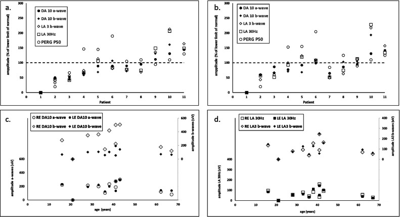 RP2-Associated X-linked Retinopathy: Clinical Findings, Molecular ...