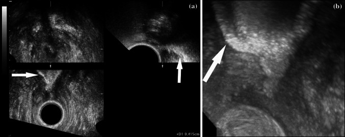 Fig. 1