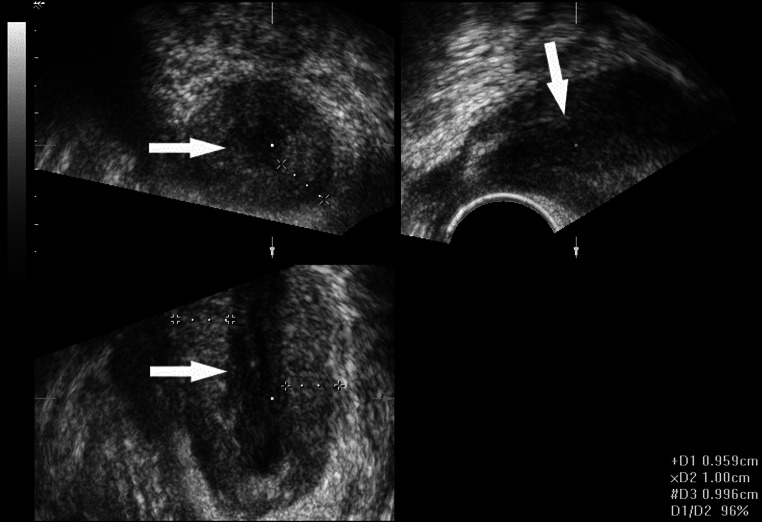 Fig. 3