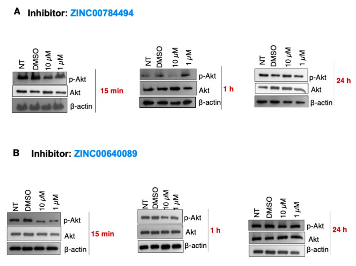 Targeting Lipocalin-2 in Inflammatory Breast Cancer Cells with Small ...