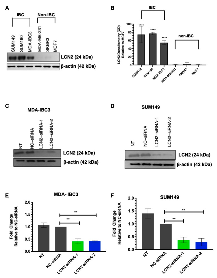 Targeting Lipocalin-2 in Inflammatory Breast Cancer Cells with Small ...