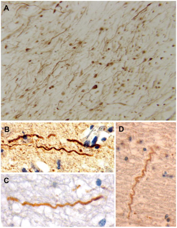 Fig. 10