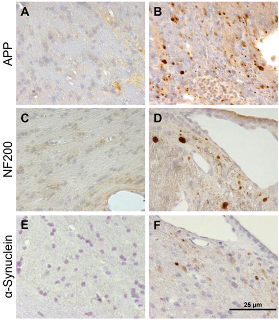 Fig. 11