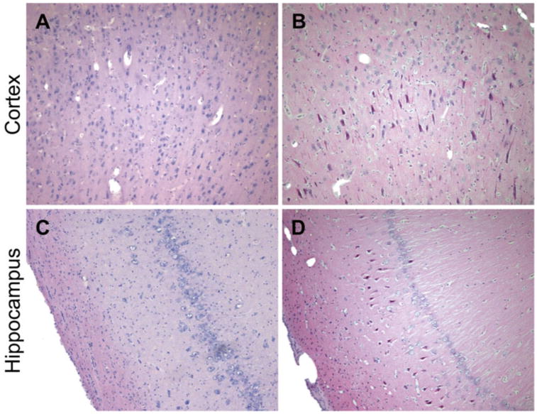 Fig. 13