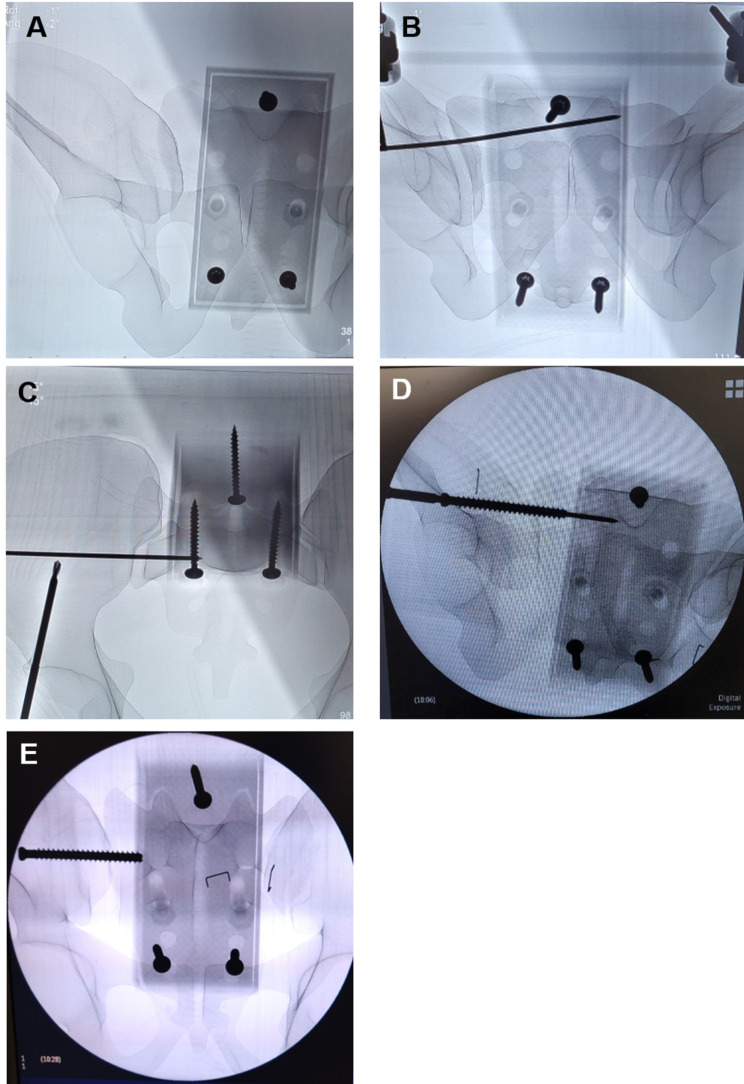 Fig. 2