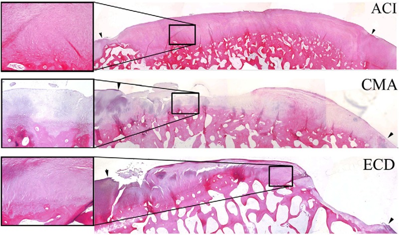 Figure 11.