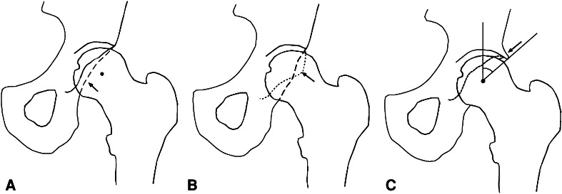 Fig. 6A–C