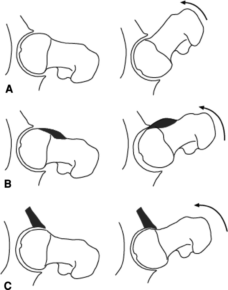 Fig. 2A–C