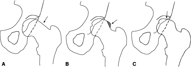 Fig. 5A–C