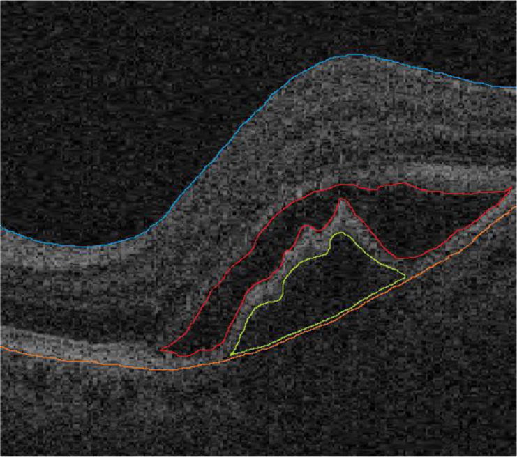 Fig. 1