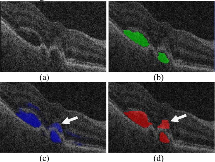 Fig. 12