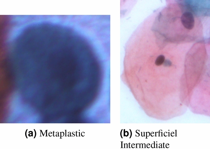 Figure 17