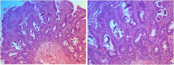 Fig. 3