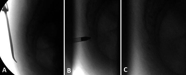 FIG. 3.