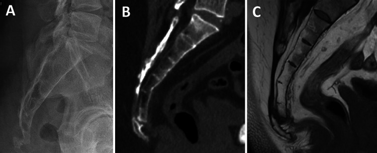 FIG. 1.