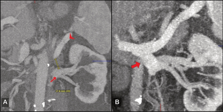 Fig. 3