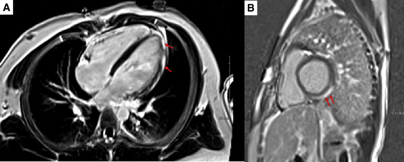 Figure 3