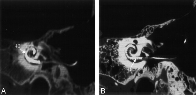 Fig 6.