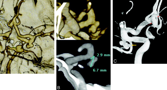 Fig 2.