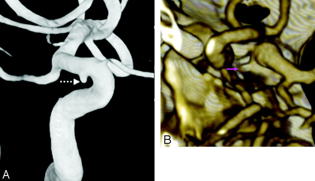 Fig 4.