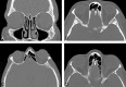 Fig 1.