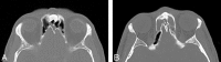 Fig 2.