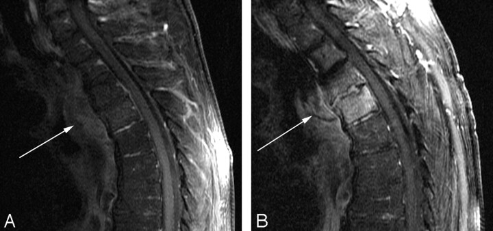 Fig 2.