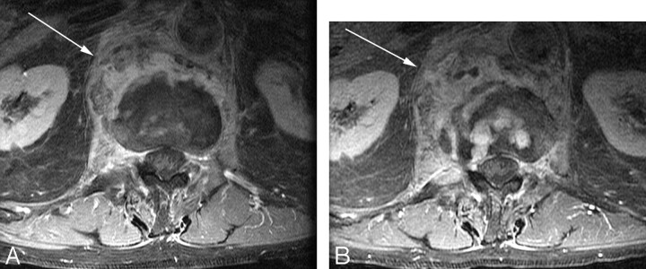 Fig 3.