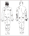 Figure II